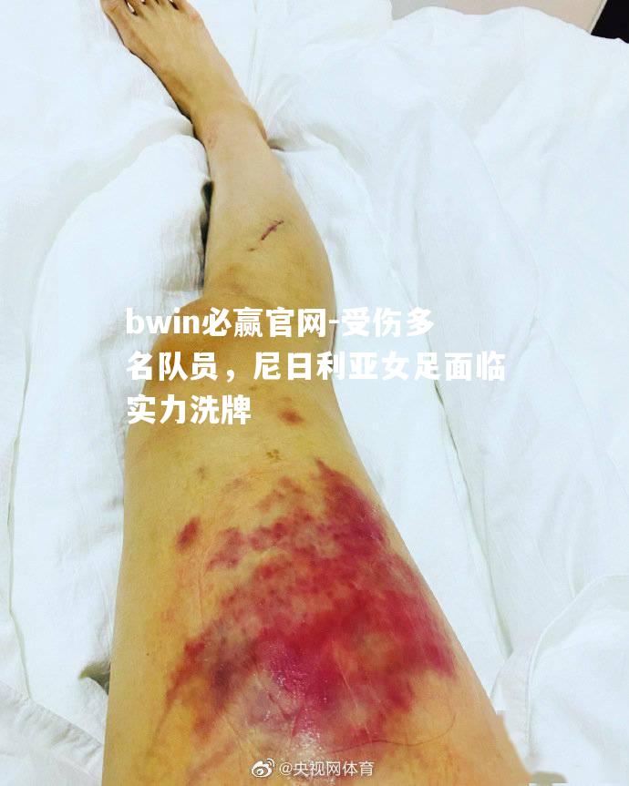 受伤多名队员，尼日利亚女足面临实力洗牌